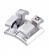 Dente_25_722-301-25